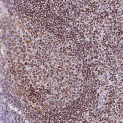 Immunohistochemistry-Paraffin: Histone Deacetylase 8/HDAC8 Antibody [NBP2-14085] - Staining of human tonsil shows strong nuclear positivity in germinal center cells.