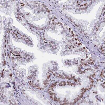 Immunohistochemistry-Paraffin: Histone Deacetylase 8/HDAC8 Antibody [NBP2-14085] - Staining of human prostate shows moderate nuclear positivity in glandular cells.