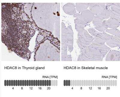 Immunohistochemistry-Paraffin: Histone Deacetylase 8/HDAC8 Antibody [NBP2-14085] - Analysis in human thyroid gland and skeletal muscle tissues. Corresponding HDAC8 RNA-seq data are presented for the same tissues.