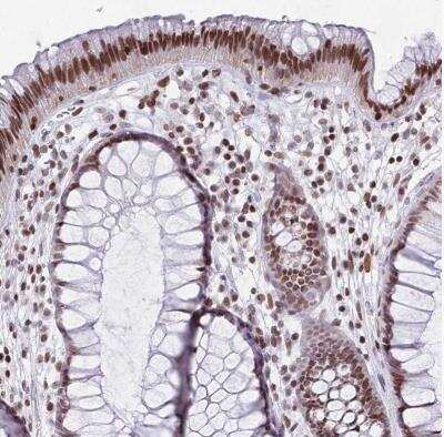 Immunohistochemistry-Paraffin: Histone Deacetylase 8/HDAC8 Antibody [NBP2-14085] - Staining of human rectum shows moderate to strong nuclear positivity in glandular cells, as well as in lymphoid cells.