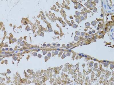 Immunohistochemistry-Paraffin: Histone Deacetylase 8/HDAC8 Antibody [NBP3-03473] - Rat testis using Histone Deacetylase 8/HDAC8 antibody at dilution of 1:100 (40x lens).