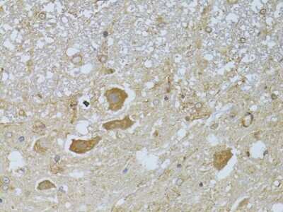 Immunohistochemistry-Paraffin: Histone Deacetylase 8/HDAC8 Antibody [NBP3-03473] - Rat spinal cord using Histone Deacetylase 8/HDAC8 antibody at dilution of 1:100 (40x lens).