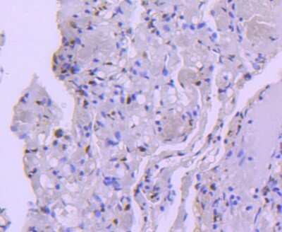 Immunohistochemistry-Paraffin: Histone Deacetylase 8/HDAC8 Antibody (JJ0845) [NBP2-67837] - Analysis of paraffin-embedded human lung tissue using anti-HDAC8 antibody. Counter stained with hematoxylin.