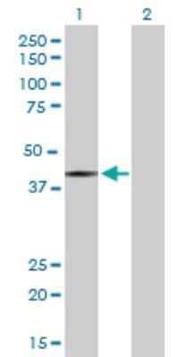 Western Blot: Histone Deacetylase 8/HDAC8 Antibody [H00055869-D01P] - Analysis of HDAC8 expression in transfected 293T cell line by HDAC8 polyclonal antibody.Lane 1: HDAC8 transfected lysate(41.80 KDa).Lane 2: Non-transfected lysate.