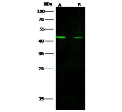 Western Blot: Histone Deacetylase 8/HDAC8 Antibody [NBP2-98969] - Anti-Histone Deacetylase 8/HDAC8 rabbit polyclonal antibody at 1:500 dilution. Lane A: A431 Whole Cell Lysate. Lane B: A549 Whole Cell Lysate. Lysates/proteins at 30 ug per lane. Secondary Goat Anti- Rabbit IgG H&L (Dylight 800) at 1/10000 dilution. Developed using the Odyssey technique. Performed under reducing conditions. Predicted band size: 42 kDa. Observed band size: 42 kDa