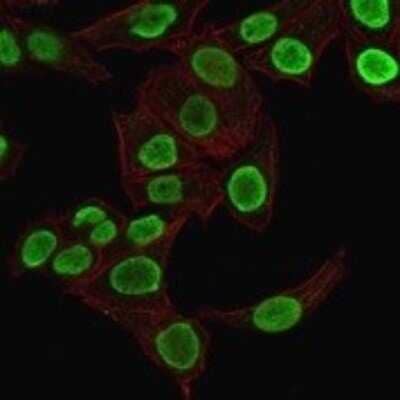 Immunocytochemistry/Immunofluorescence: H1F0 Antibody (1415-1) - Azide and BSA Free [NBP2-47752] - Confocal Immunofluorescence image of HeLa cells using H1F0 antibody (1415-1) - Azide and BSA Free stained green (CF488) and Phalloidin is used to label the membranes.