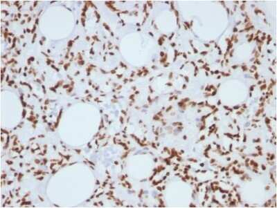 Immunohistochemistry-Paraffin: H1F0 Antibody (1415-1) - Azide and BSA Free [NBP2-47752] - Formalin-fixed, paraffin-embedded human Angiosarcoma stained with H1F0 antibody (1415-1) - Azide and BSA Free