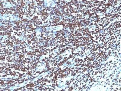 Immunohistochemistry-Paraffin: H1F0 Antibody (1415-1) - IHC-Prediluted [NBP2-48078] - Human Tonsil stained with Histone H1 Monoclonal antibody (1415-1)