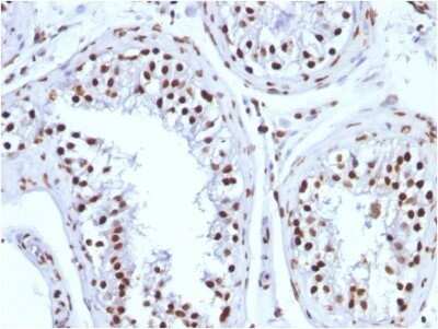 Immunohistochemistry-Paraffin: H1F0 Antibody (1415-1) - IHC-Prediluted [NBP2-48078] - Formalin-fixed, paraffin-embedded human Testicular Carcinoma stained with H1F0 antibody (1415-1) - IHC-Prediluted