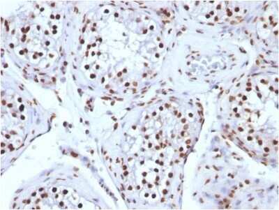 Immunohistochemistry-Paraffin: H1F0 Antibody (AE-4) - IHC-Prediluted [NBP2-48077] - Formalin-fixed, paraffin-embedded human Testicular Carcinoma stained with H1F0 antibody (AE-4) - IHC-Prediluted