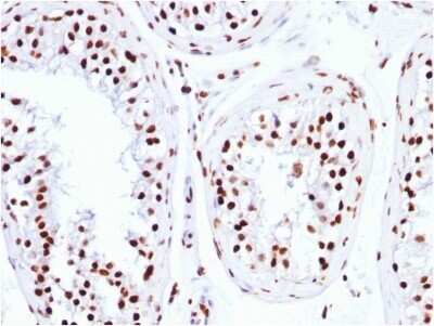 Immunohistochemistry-Paraffin: Histone H1 Antibody (HH1/957) - IHC-Prediluted [NBP2-48087] - Formalin-fixed, paraffin-embedded human Testicular Carcinoma stained with Histone H1 Antibody (HH1/957).