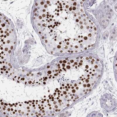 Immunohistochemistry-Paraffin: Histone H1T Antibody [NBP2-57668] - Immunohistochemical staining of human testis shows nuclear positivity in ductus seminiferous.