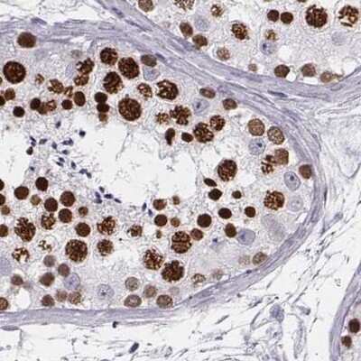Immunohistochemistry-Paraffin: Histone H1T Antibody [NBP2-57668] - Staining of human testis.