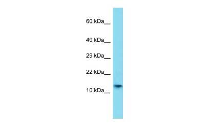 Western Blot: Histone H2A-Bbd type 1 Antibody [NBP3-09611] - Western blot analysis of Histone H2A-Bbd type 1 in A549 Whole Cell lysates. Antibody dilution at 1.0ug/ml