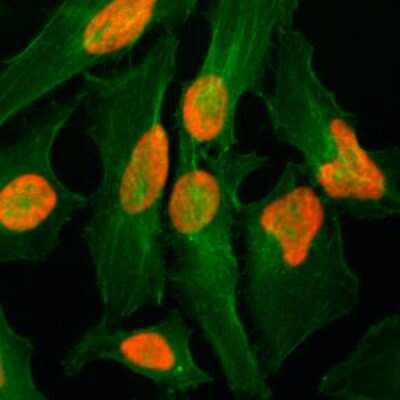 Immunocytochemistry/Immunofluorescence: Histone H2A.Z Antibody (RM215) [NBP2-61488] - Immunocytochemistry of HeLa cells, using Histone H2AZ Rabbit mAb NBP2-61488 (red). Actin filaments have been labeled with fluorescein phalloidin (green).