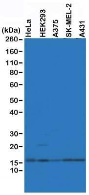 Western Blot: Histone H2A.Z Antibody (RM215) [NBP2-61488] - Western Blot of HeLa, HEK293, A375, SK-MEL-2 and A431 whole cell lysates, using NBP2-61488, showed endogenous Histone H2AZ in HeLa, HEK293, A375, SK-MEL-2 and A431 cells.