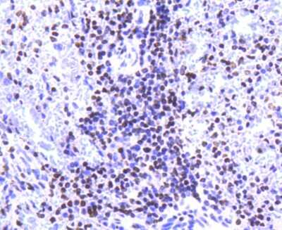 Immunohistochemistry-Paraffin: Histone H2A.Z Antibody (ST46-09) [NBP2-67499] - Analysis of paraffin-embedded human spleen tissue using anti-Histone H2A.Z antibody. Counter stained with hematoxylin.