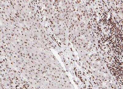 Immunohistochemistry-Paraffin: Histone H2A.Z Antibody (ST46-09) [NBP2-67499] -  Human liver tissue with Rabbit anti-Histone H2A.Z antibody at 1/200 dilution.The section was pre-treated using heat mediated antigen retrieval with sodium citrate buffer (pH 6.0) for 2 minutes. The tissues were blocked in 1% BSA for 20 minutes at room temperature, washed with ddH2O and PBS, and then probed with the primary antibody  at 1/200 dilution for 1 hour at room temperature. The detection was performed using an HRP conjugated compact polymer system. DAB was used as the chromogen. Tissues were counterstained with hematoxylin and mounted with DPX.