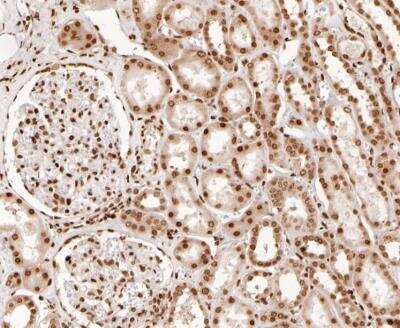 Immunohistochemistry-Paraffin: Histone H2A.Z Antibody (ST46-09) [NBP2-67499] - Human kidney tissue with Rabbit anti-Histone H2A.Z antibody at 1/200 dilution.The section was pre-treated using heat mediated antigen retrieval with sodium citrate buffer (pH 6.0) for 2 minutes. The tissues were blocked in 1% BSA for 20 minutes at room temperature, washed with ddH2O and PBS, and then probed with the primary antibody  at 1/200 dilution for 1 hour at room temperature. The detection was performed using an HRP conjugated compact polymer system. DAB was used as the chromogen. Tissues were counterstained with hematoxylin and mounted with DPX.