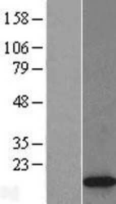 Western Blot: Histone H2A.Z Overexpression Lysate (Adult Normal) [NBL1-11427] Left-Empty vector transfected control cell lysate (HEK293 cell lysate); Right -Over-expression Lysate for Histone H2A.Z.