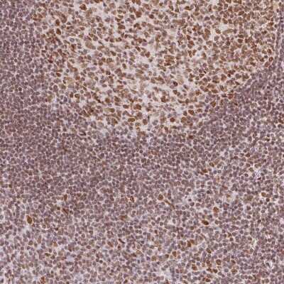 Immunohistochemistry-Paraffin: Histone H2A.Z Antibody [NBP2-58444] - Immunohistochemical staining of human tonsil shows nuclear positivity in germinal center and non-germinal center cells.