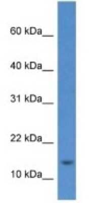 Western Blot: Histone H2AE Antibody [NBP1-79880] - RPMI-8226 Whole Cell, concentration 1 ug/ml.