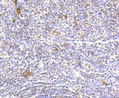 Immunohistochemistry-Paraffin: Histone H2AE [Hydroxy Tyr39] Antibody (SR4-17) [NBP2-67337] - Analysis of paraffin-embedded human tonsil tissue using anti-Histone H2A(hydroxyl Y39) antibody. Counter stained with hematoxylin.