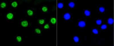 Immunocytochemistry/Immunofluorescence: Histone H2AE [ac Lys9] Antibody (SR4-15) [NBP2-67336] - Staining Histone H2A(acetyl K9) in A549 cells (green). The nuclear counter stain is DAPI (blue). Cells were fixed in paraformaldehyde, permeabilised with 0.25% Triton X100/PBS.