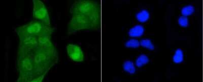 Immunocytochemistry/Immunofluorescence: Histone H2AE [ac Lys9] Antibody (SR4-15) [NBP2-67336] - Staining Histone H2A(acetyl K9) in Hela cells (green). The nuclear counter stain is DAPI (blue). Cells were fixed in paraformaldehyde, permeabilised with 0.25% Triton X100/PBS.