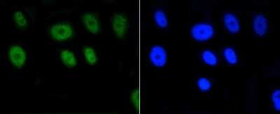 Immunocytochemistry/Immunofluorescence: Histone H2AE [ac Lys9] Antibody (SR4-15) [NBP2-67336] - Staining Histone H2A(acetyl K9) in MCF-7 cells (green). Cells were fixed in paraformaldehyde, permeabilised with 0.25% Triton X100/PBS.