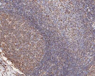 Immunohistochemistry-Paraffin: Histone H2AE [ac Lys9] Antibody (SR4-15) [NBP2-67336] - Immunohistochemical analysis of paraffin-embedded human tonsil tissue using anti- Histone H2AE antibody. Counter stained with hematoxylin.