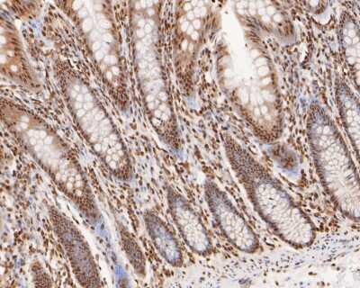 Immunohistochemistry-Paraffin: Histone H2AE [ac Lys9] Antibody (SR4-15) [NBP2-67336] - immunohistochemical analysis of paraffin-embedded human colon tissue using anti-Histone H2AE antibody. The counter was dyed with hematoxylin.