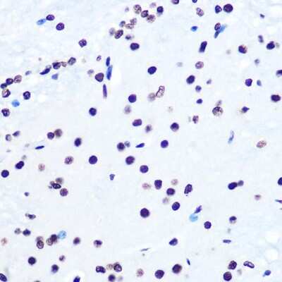 Immunohistochemistry-Paraffin: Histone H2AX Antibody (4Z3S8) [NBP3-15378] - Immunohistochemistry of paraffin-embedded Rat brain using Histone H2AX antibody (NBP3-15378) at dilution of 1:100 (40x lens).Perform microwave antigen retrieval with 10 mM PBS buffer pH 7.2 before commencing with IHC staining protocol.