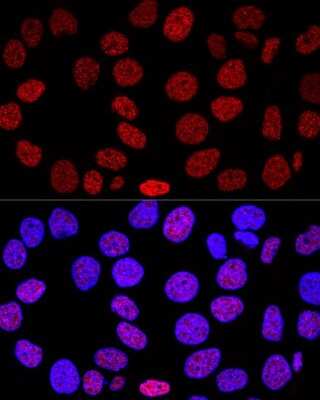 Immunocytochemistry/Immunofluorescence: Histone H2AX Antibody [NBP3-04113] - Analysis of HeLa cells using Histone H2Ax antibody at dilution of 1:200. Blue: DAPI for nuclear staining.