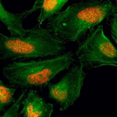 Immunocytochemistry/Immunofluorescence: Histone H2AX Antibody (RM214) [NBP3-18534] - Immunocytochemistry of HeLa cells, using NBP3-18534 (red). Actin filaments have been labeled with fluorescein phalloidin (green).