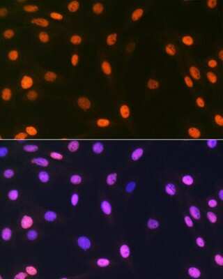 Immunocytochemistry/Immunofluorescence: Histone H2AY/macroH2A.1 Antibody (4D2O4) [NBP3-16743] - Immunofluorescence analysis of C6 cells using Histone H2AY/macroH2A.1 Rabbit mAb (NBP3-16743) at dilution of 1:100 (40x lens). Blue: DAPI for nuclear staining.