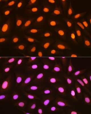 Immunocytochemistry/Immunofluorescence: Histone H2AY/macroH2A.1 Antibody (4D2O4) [NBP3-16743] - Immunofluorescence analysis of U-2 OS cells using Histone H2AY/macroH2A.1 Rabbit mAb (NBP3-16743) at dilution of 1:100 (40x lens). Blue: DAPI for nuclear staining.