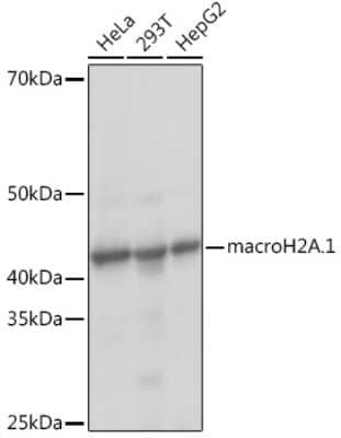 Western Blot: Histone H2AY/macroH2A.1 Antibody (4D2O4) [NBP3-16743] - Western blot analysis of extracts of various cell lines, using Histone H2AY/macroH2A.1 Rabbit mAb (NBP3-16743) at 1:1000 dilution. Secondary antibody: HRP Goat Anti-Rabbit IgG (H+L) at 1:10000 dilution. Lysates/proteins: 25ug per lane. Blocking buffer: 3% nonfat dry milk in TBST. Detection: ECL Basic Kit. Exposure time: 1s.