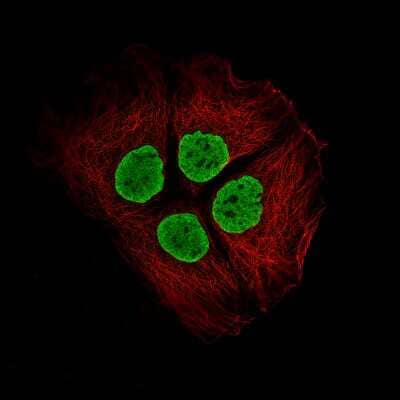 Immunocytochemistry/Immunofluorescence: Histone H2AY/macroH2A.1 Antibody (CL5245) [NBP2-61155] - Staining of CACO-2 cells using the Anti-H2AFY monoclonal antibody, showing specific staining in the nucleoplasm in green. Microtubule- and nuclear probes are visualized in red and blue, respectively (where available).