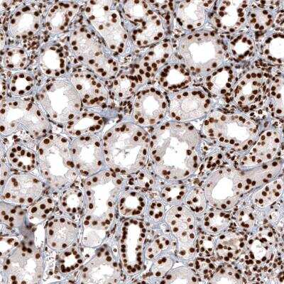 Immunohistochemistry-Paraffin: Histone H2AY/macroH2A.1 Antibody (CL5245) [NBP2-61155] - staining of human kidney shows strong nuclear positivity in renal tubules cells.