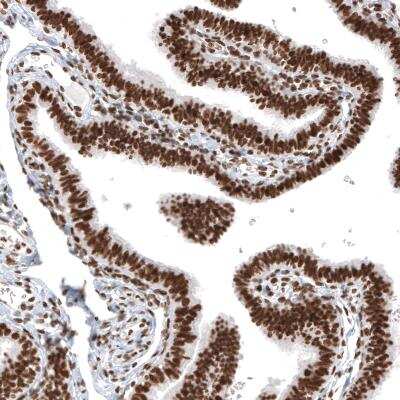 Immunohistochemistry-Paraffin: Histone H2AY/macroH2A.1 Antibody (CL5245) [NBP2-61155] - staining of human fallopian tube shows strong nuclear positivity in glandular and stromal cells.