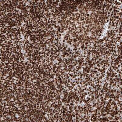 Immunohistochemistry-Paraffin: Histone H2AY/macroH2A.1 Antibody (CL5245) [NBP2-61155] - staining of human tonsil shows strong nuclear immunoreactivity in lymphoid cells.
