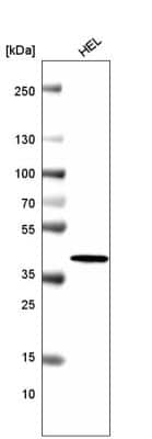 Western Blot: Histone H2AY/macroH2A.1 Antibody (CL5245) [NBP2-61155] - analysis in human cell line HEL.
