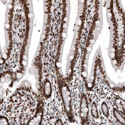 Immunohistochemistry: Histone H2AY/macroH2A.1 Antibody (CL5256) [NBP2-61644] - Staining of human duodenum shows strong nuclear immunoreactivity in glandular cells and in lamina propria cells.