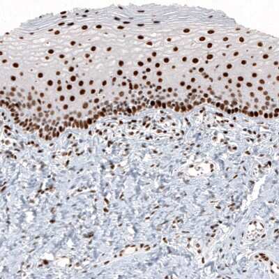 Immunohistochemistry: Histone H2AY/macroH2A.1 Antibody (CL5256) [NBP2-61644] - Staining of human cervix shows strong nuclear positivity in squamous epithelial cells and in connective tissue cells.