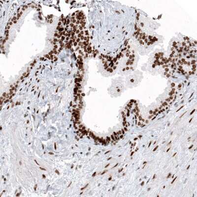 Immunohistochemistry: Histone H2AY/macroH2A.1 Antibody (CL5256) [NBP2-61644] - Staining of human prostate shows strong nuclear immunoreactivity in glandular and smooth muscle cells.