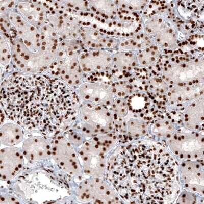 Immunohistochemistry: Histone H2AY/macroH2A.1 Antibody (CL5256) [NBP2-61644] - Staining of human kidney shows strong nuclear positivity in renal glomeruli and renal tubules cells.