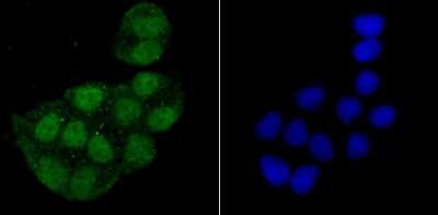 Immunocytochemistry/Immunofluorescence: Histone H2AY/macroH2A.1 Antibody (JU22-83) [NBP2-75523] - Staining macroH2A.1 in Hela cells (green). The nuclear counter stain is DAPI (blue). Cells were fixed in paraformaldehyde, permeabilised with 0.25% Triton X100/PBS.