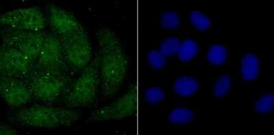 Immunocytochemistry/Immunofluorescence: Histone H2AY/macroH2A.1 Antibody (JU22-83) [NBP2-75523] - Staining macroH2A.1 in HepG2 cells (green). The nuclear counter stain is DAPI (blue). Cells were fixed in paraformaldehyde, permeabilised with 0.25% Triton X100/PBS.