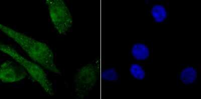 Immunocytochemistry/Immunofluorescence: Histone H2AY/macroH2A.1 Antibody (JU22-83) [NBP2-75523] - Staining macroH2A.1 in PC-3M cells (green). The nuclear counter stain is DAPI (blue). Cells were fixed in paraformaldehyde, permeabilised with 0.25% Triton X100/PBS.